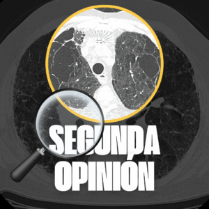 Segunda opinión radiológica